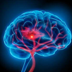 Care of Brain Injury Policy (Dom Care) £27